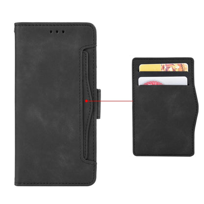 For Doogee X98 Skin Feel Calf Texture Card Slots Leather Phone Case(Black) - Doogee Cases by buy2fix | Online Shopping UK | buy2fix